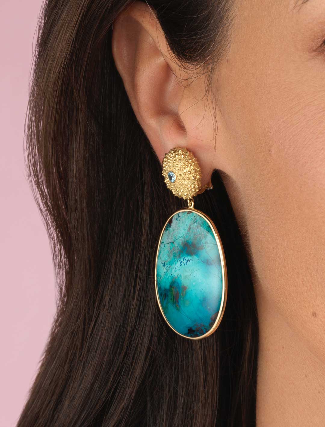 Urchin-Drp-Shattuckite-ER-1a